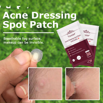 Skin Care Tools Acne Dressing Spot Patch